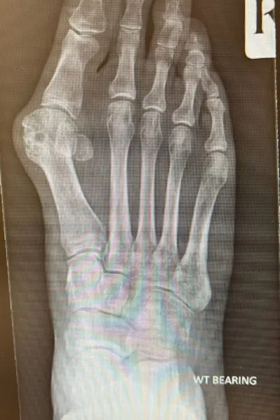 Xrays 1