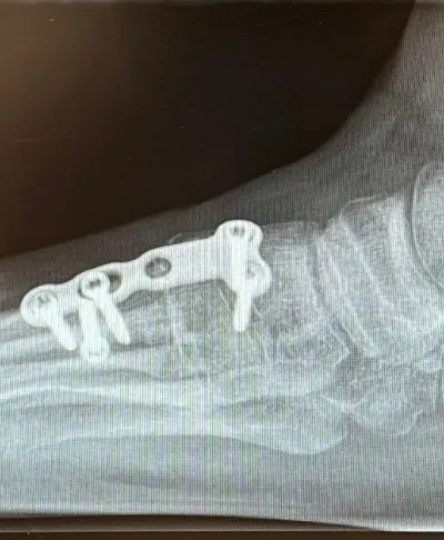 xrays 4