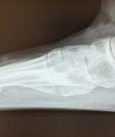 xrays 2