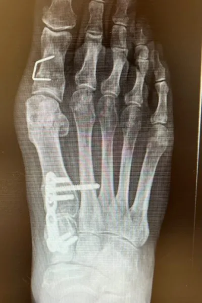Xrays 3